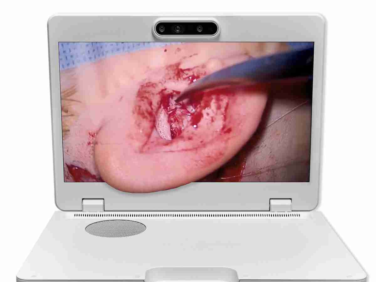 达擎之＂Heads-up 3D显微手术显示系统＂，，，，整合4K裸眼3D显示及眼球追踪系统，，具备快速追踪人眼移动位置功能，，，减轻医师长时间维持固定姿势的负担，，，让医师能有更宽广清晰的3D立体视野及更舒适的姿势来执行手术。。。。